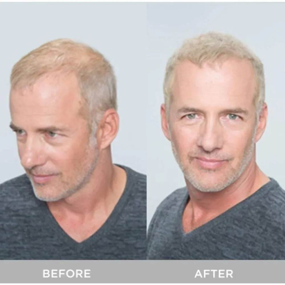 XFusion Keratin‎ Hair Fibers-Dark Brown-Economy Size